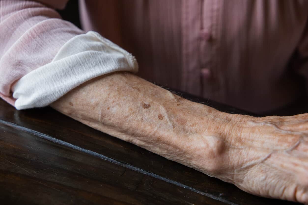 What Are Elderly Skin Unique Needs And How To Provide Skin care
