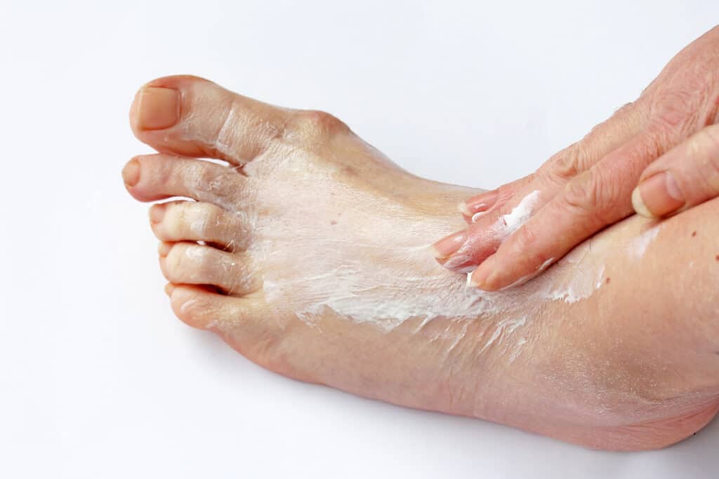 moisturizing old people's feet