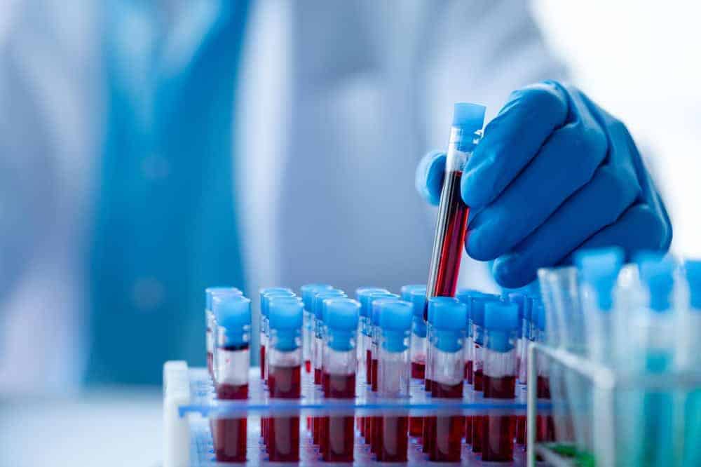 An image of blood samples with a doctor holding one tube.